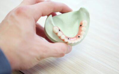Cosmetic crowns and veneers