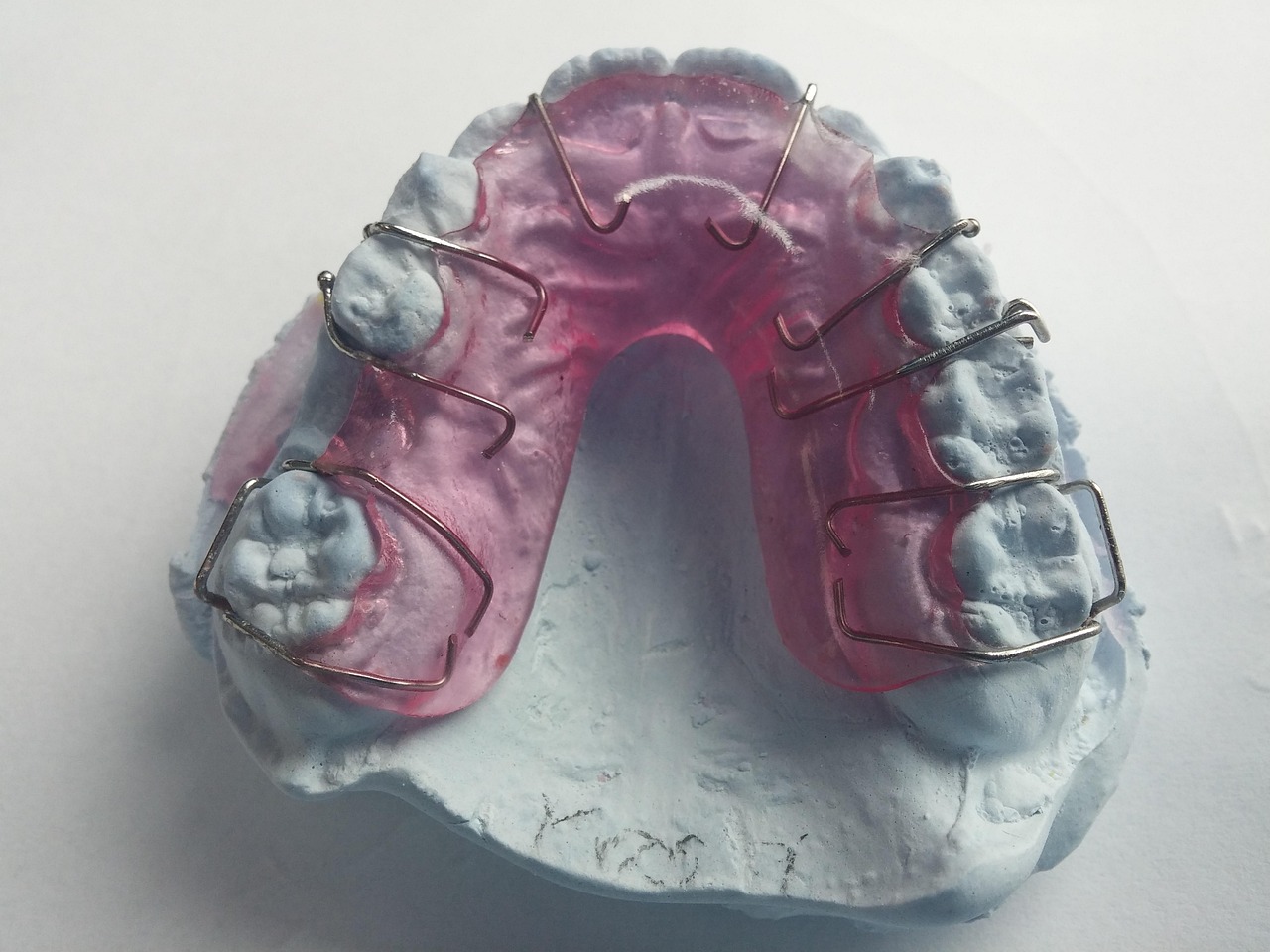 regular braces or invisalign
